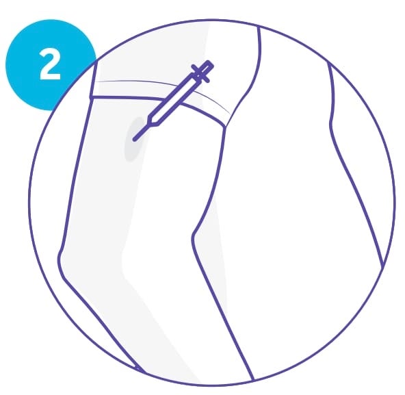 Insulin injection site on the upper arm.
