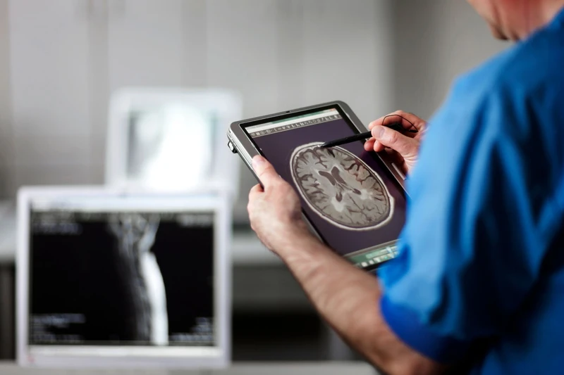 Provider holding a tablet with a brain scan 