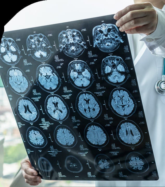  A doctor holding and reviewing a medical scan