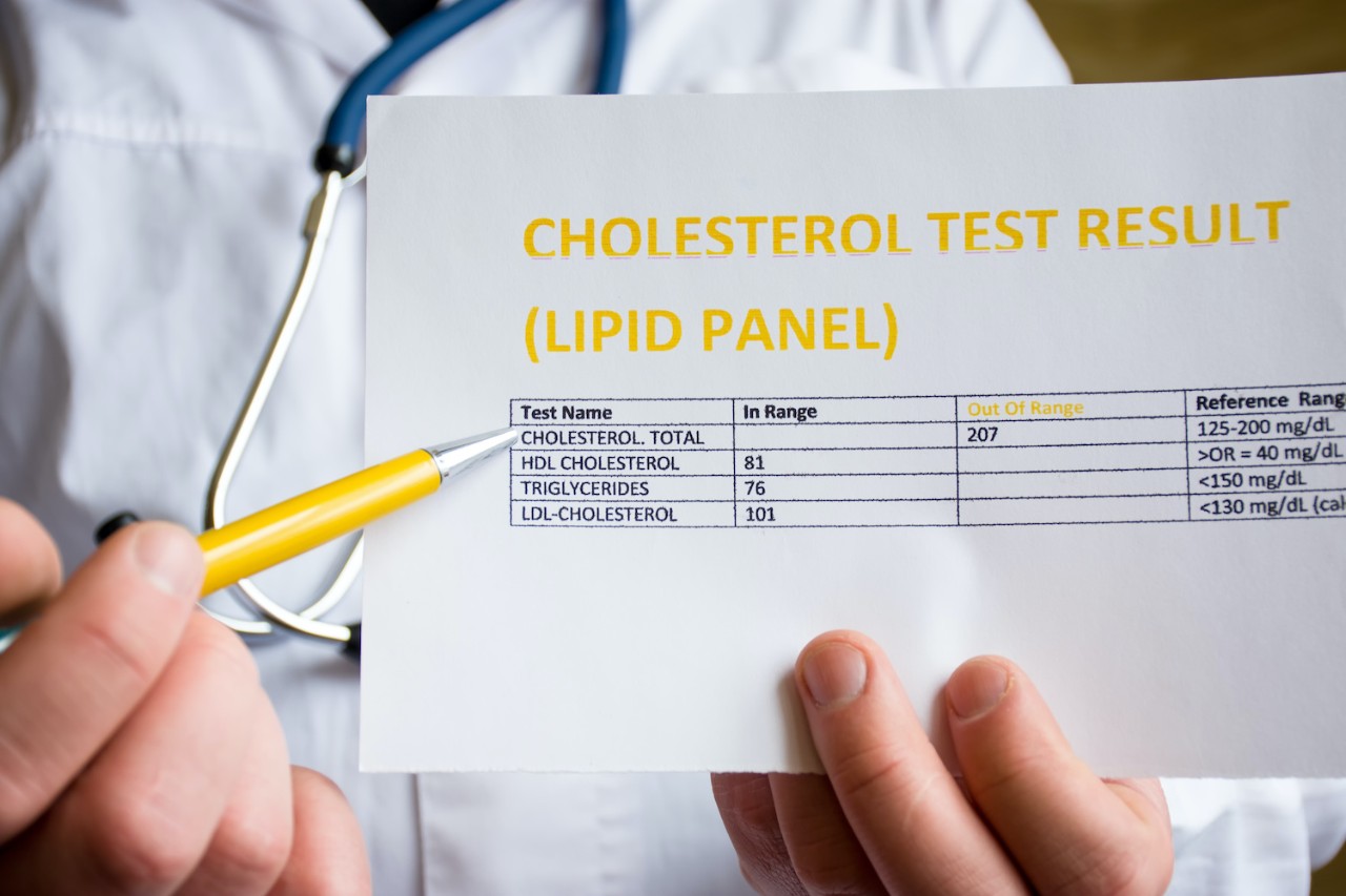 Doctor indicates patient or colleague on cholesterol test result or lipid panel, standing in white medical coat. Concept photo to illustrate diagnostic and screening of high or low blood cholesterol