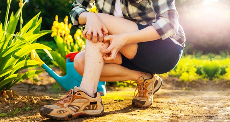 Person scratching insect bites on their leg while gardening outdoors.