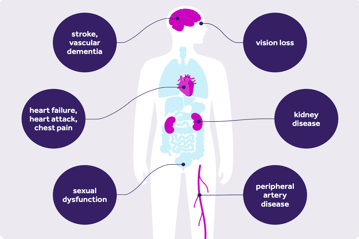Diagram showing the effects of high blood pressure on different parts of the body.