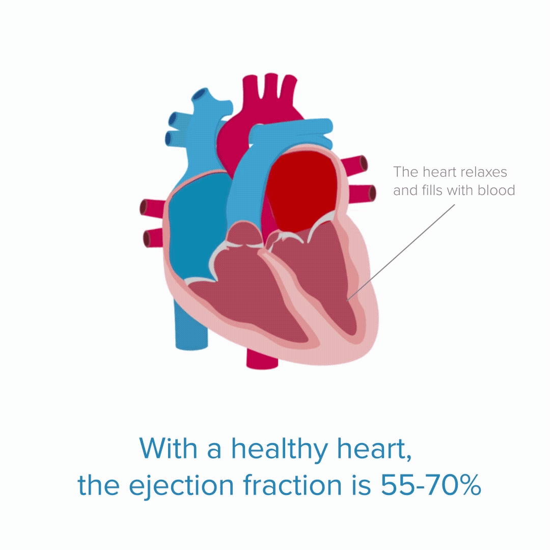 Illustration of a healthy heart with labeled parts, noting that the ejection fraction is 55-70% during heart relaxation and filling.