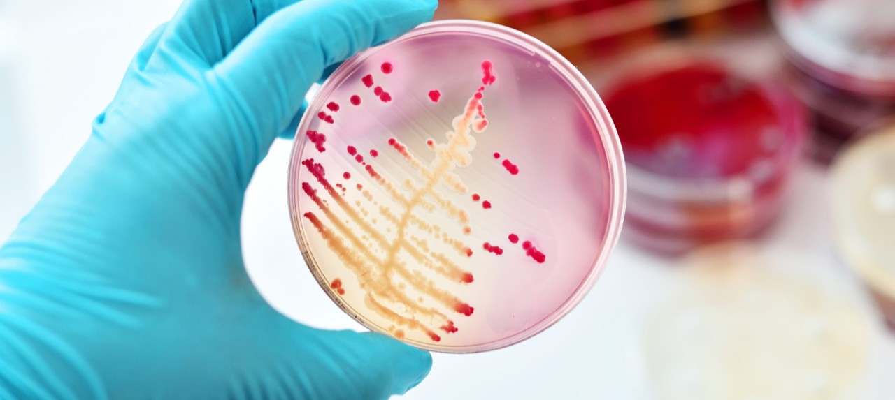  A gloved hand holding a petri dish with colorful bacterial growth, showcasing a variety of patterns