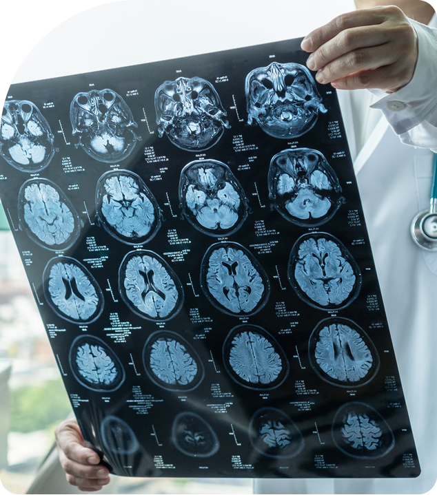  A doctor holding and reviewing a medical scan